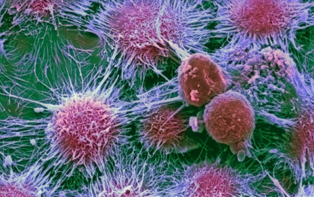 Раковые опухоли держат часть мутаций «про запас»