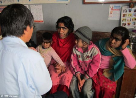 Непальская семья с редкой болезнью