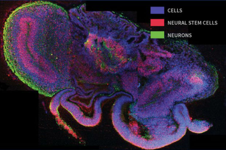 головной мозг из стволовых клеток