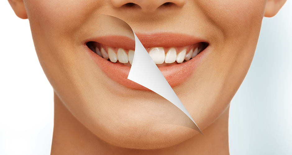 Как делается ультразвуковая чистка зубов